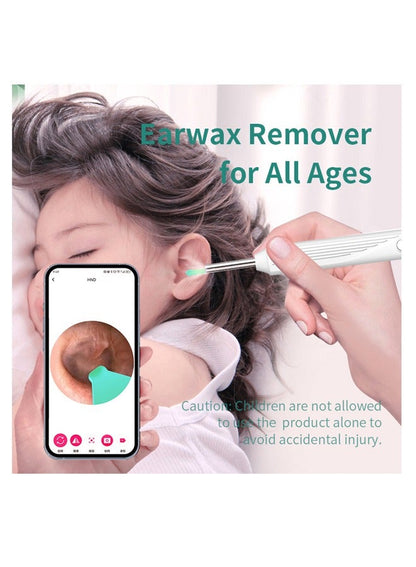 Ear Wax Removal Kit - Visible Ear Wax Remover With Camera
