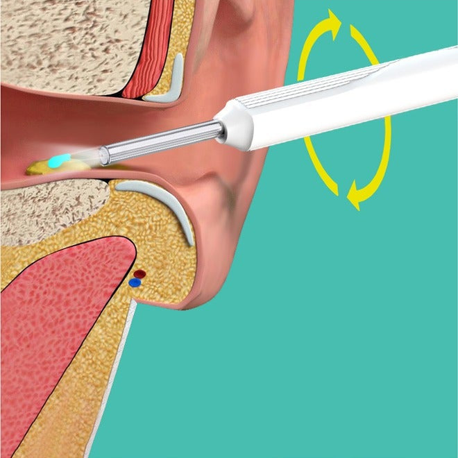 Ear Wax Removal Kit - Visible Ear Wax Remover With Camera