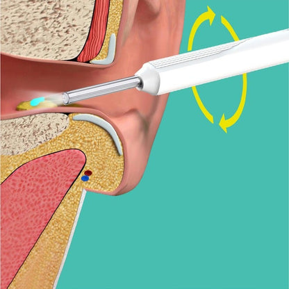 Ear Wax Removal Kit - Visible Ear Wax Remover With Camera