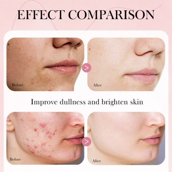 Anua Wonder Peach 70% Niacinamide Serum